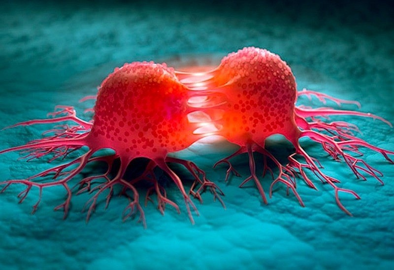 Bác sĩ Mỹ chia sẻ 5 món ăn nhẹ làm tăng khả năng chống ung thư ruột kết gấp bội, ban đầu thấy lạ nhưng “càng ăn càng mê”