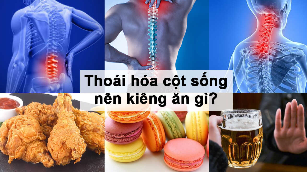 Những món ăn tốt nhất cho người bị thoái hóa cột sống- Ảnh 3. Những món ăn tốt nhất cho người bị thoái hóa cột sống- Ảnh 3.